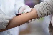 Semua Dewasa Di Singapura Digalak Ambil Ujian HIV Sekurang-kurangnya Sekali